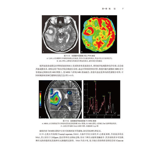 脑部分册 临床磁共振成像系列丛书 程敬亮 文宝红 张勇 主编 涵盖了脑部绝大部分常见和少见疾病相关临床知识和磁共振征象等 商品图4