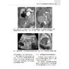 胎儿磁共振成像（中文翻译版）王荣品 钟玉敏主译 适用各级影像科医生及妇产科科医生 胎儿磁共振诊断初学者学习 科学出版社 商品缩略图4