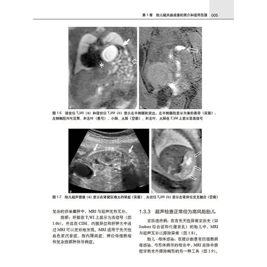胎儿磁共振成像（中文翻译版）王荣品 钟玉敏主译 适用各级影像科医生及妇产科科医生 胎儿磁共振诊断初学者学习 科学出版社 商品图4