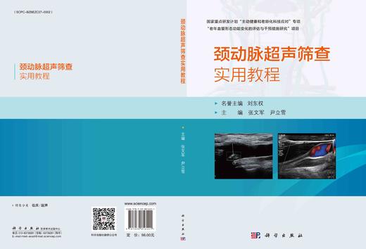 颈动脉超声筛查实用教程 商品图3