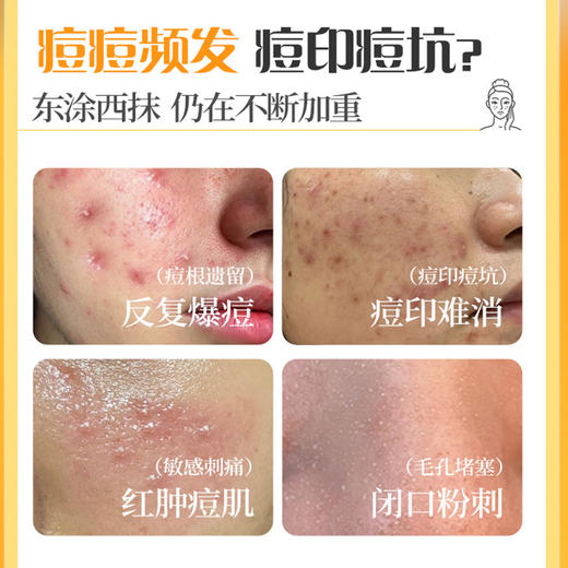 片仔癀祛痘套盒 | 祛痘膏+修护凝胶+祛痘贴 | 祛痘修护二合一，油痘肌救星！痘印无踪，焕亮肌肤！ 商品图1