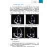 心超笔记 第2二辑 杨好意 主编 共享393段视频 读文读图读视频 适用心内外科医师 心脏超声科医师等 影像医学与核医学 科学出版社 商品缩略图4