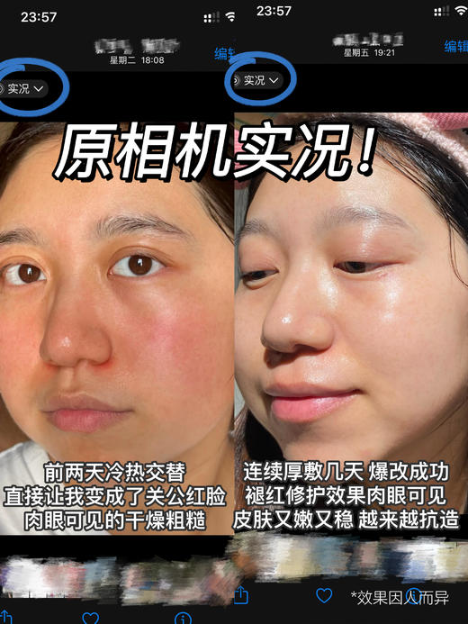 敏肌抗老专研！【Biorrier珀芙研×复旦大学溯源首发专场】超大力度的活动！⁬载人航天技术合作伙伴！华山医院皮肤科医研共创！把“‭藏药源泉”⁨西藏温泉水🌊应用到产品中，治愈受损养厚屏障 商品图7