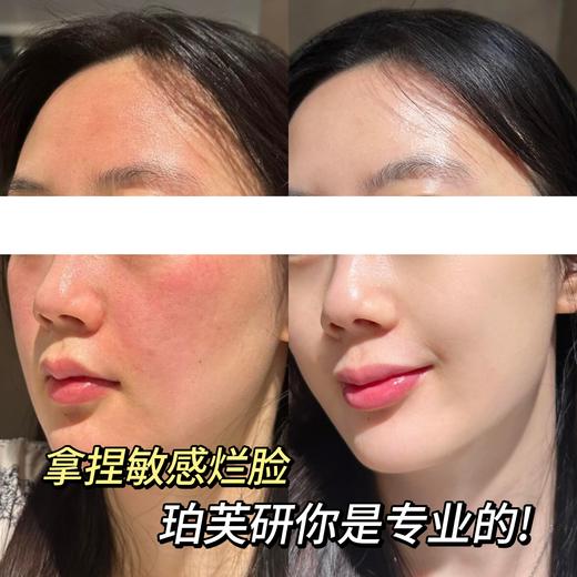 敏肌抗老专研！【Biorrier珀芙研×复旦大学溯源首发专场】超大力度的活动！⁬载人航天技术合作伙伴！华山医院皮肤科医研共创！把“‭藏药源泉”⁨西藏温泉水🌊应用到产品中，治愈受损养厚屏障 商品图1