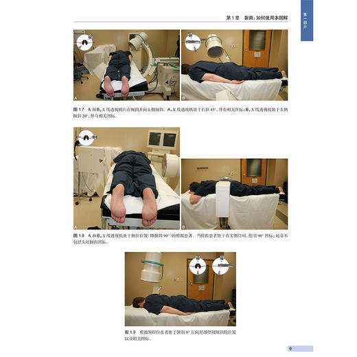 影像引导下脊柱介入操作图解 第2二版 毕胜 译 第2版以高度可视化的图解形式展示了各种介入操作技术 9787117373494人民卫生出版社 商品图4