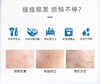 敷尔佳清痘净肤修护面部祛痘面膜油痘肌补水保湿 商品缩略图2
