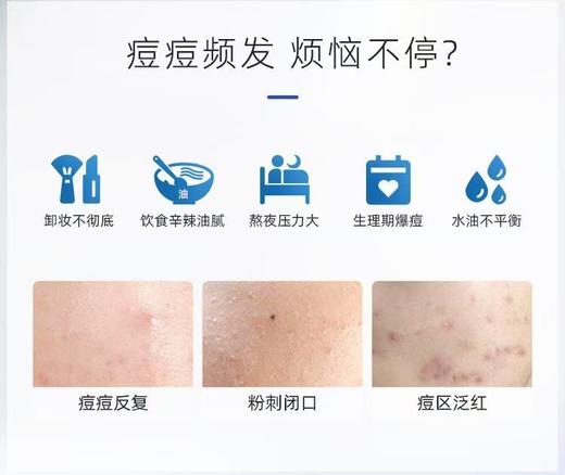敷尔佳清痘净肤修护面部祛痘面膜油痘肌补水保湿 商品图2