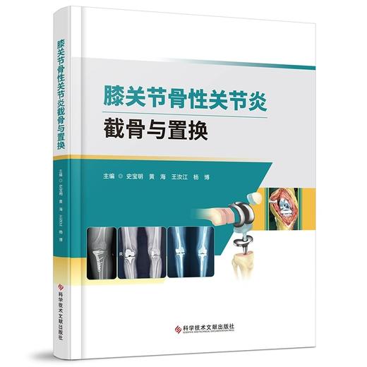 膝关节骨性关节炎截骨与置换 史宝明黄海 介绍了截骨保膝手术 单髁置换及全膝关节置换三种手术方式 骨伤医学书科学技术文献出版社 商品图1