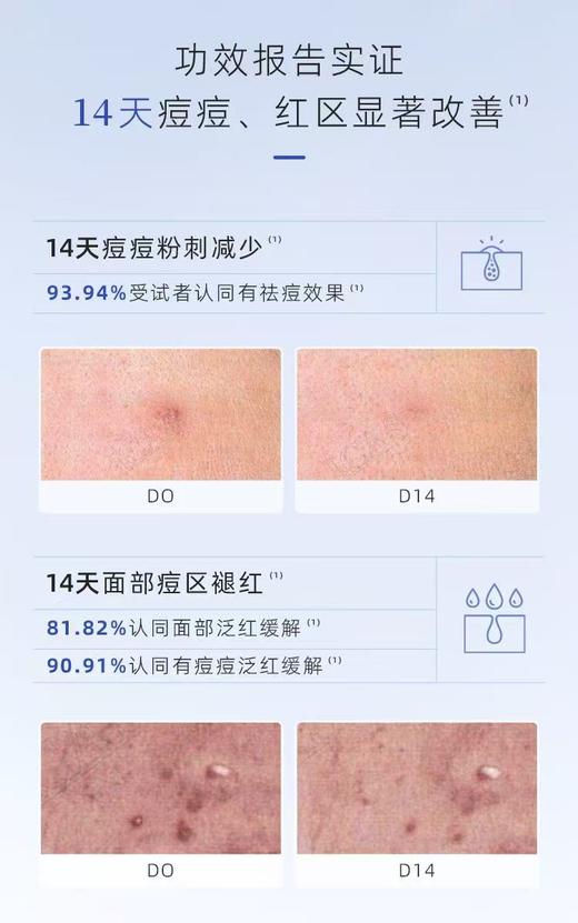 敷尔佳清痘净肤修护面部祛痘面膜油痘肌补水保湿 商品图1