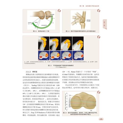人工膝关节置换术基本原理与核心技术 [德]罗兰·贝克尔 介绍了TKA的历史 手术方法和技术 最先进的诊断技术 病理特异性的治疗选择 商品图3