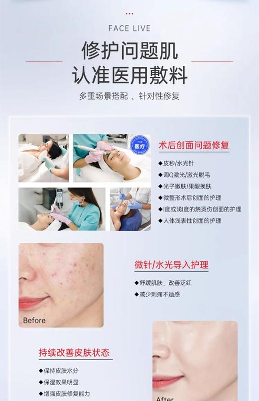 斐思妮医用重组胶原敷料（灯泡膜械字号） 商品图5