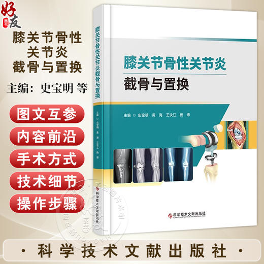 膝关节骨性关节炎截骨与置换 史宝明黄海 介绍了截骨保膝手术 单髁置换及全膝关节置换三种手术方式 骨伤医学书科学技术文献出版社 商品图0