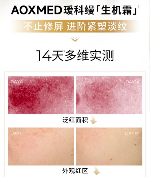 瑷科缦AOXMED密集赋活精华面霜生机霜15g 商品图4