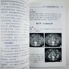 淋巴系统影像诊断 商品缩略图6