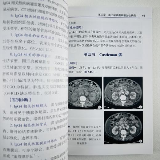 淋巴系统影像诊断 商品图6