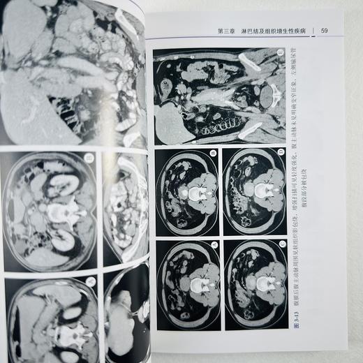淋巴系统影像诊断 商品图7