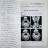 淋巴系统影像诊断 商品缩略图8