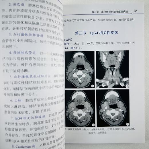 淋巴系统影像诊断 商品图8