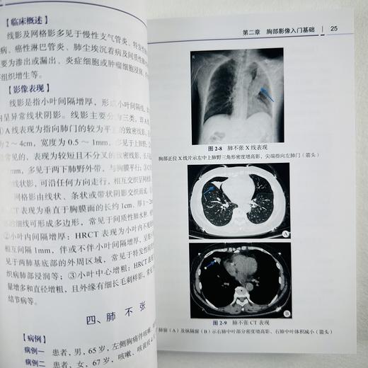 胸部影像诊断 商品图8