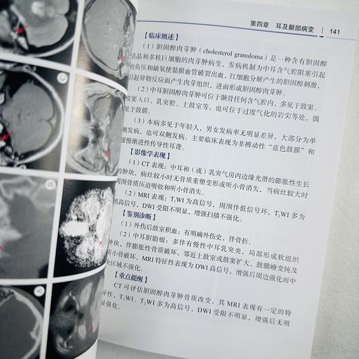 头颈部影像诊断 商品图9