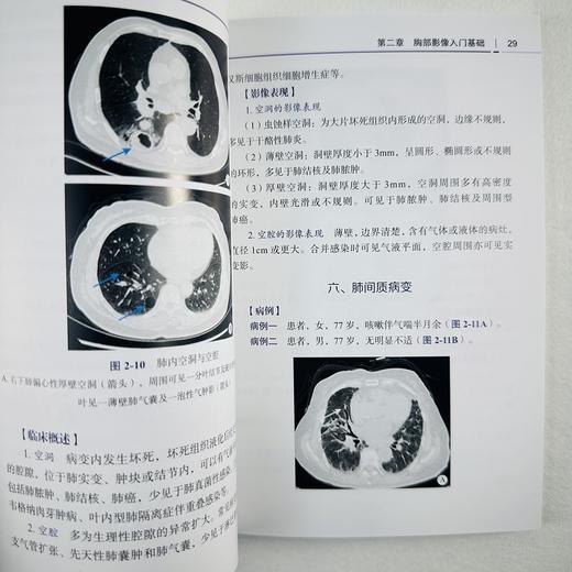 胸部影像诊断 商品图7