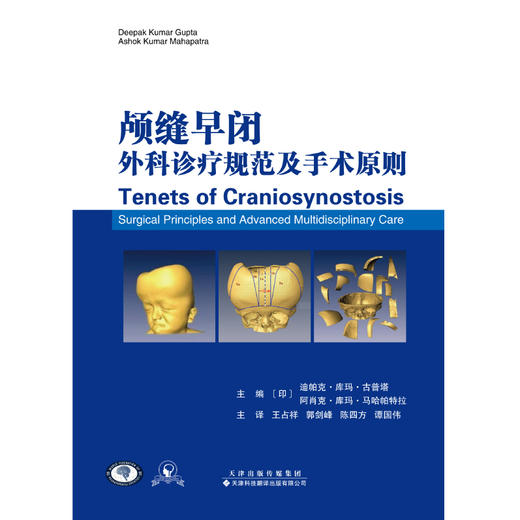 颅缝早闭外科诊疗规范及手术原则 商品图1