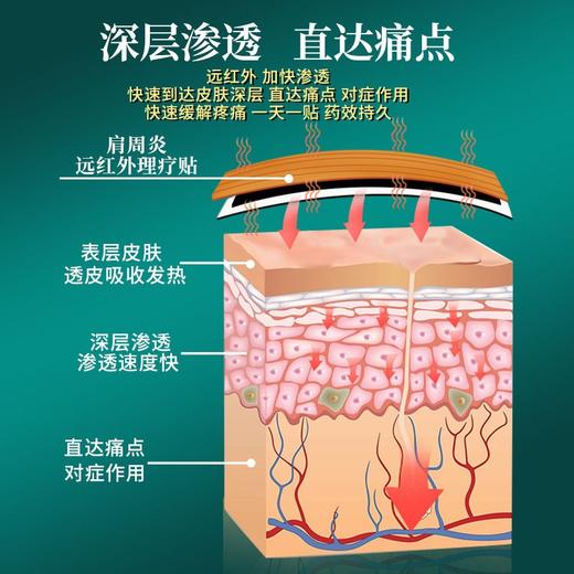 【官方正品】云南白药泰邦远红外理疗贴膏药贴肩周炎关节炎腰间盘突出骨质增生颈椎病扭挫伤 商品图2