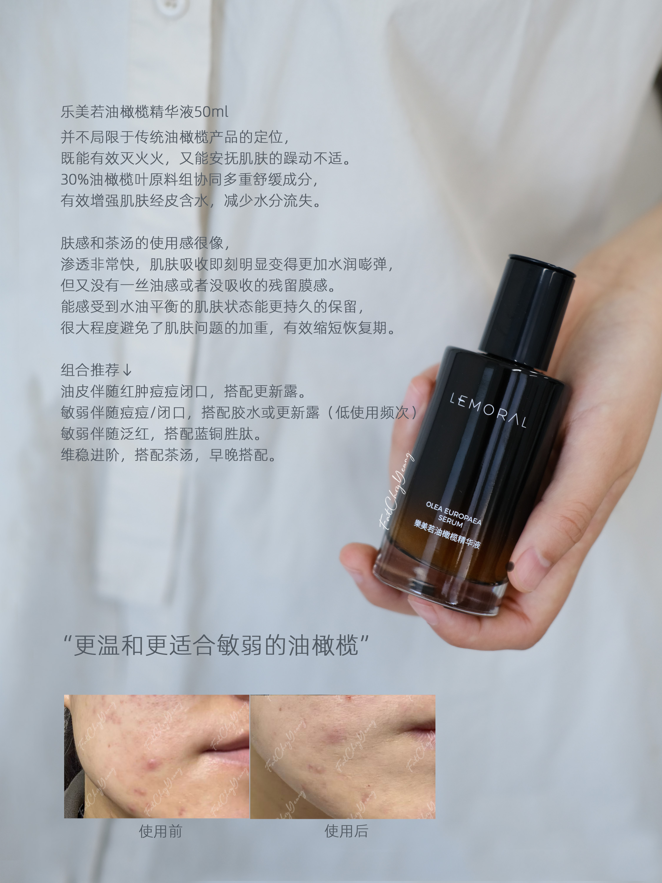 保湿舒缓 油敏痘肌|乐美若油橄榄精华液50ml 更适合敏弱的痘痘肌肤退红保湿