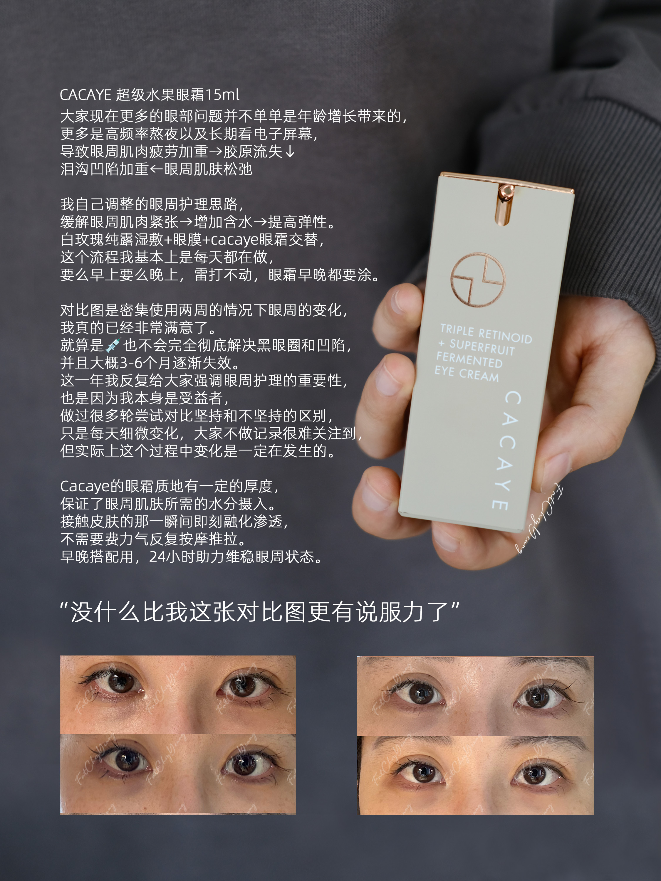 保税仓|CACAYE 超级水果发酵眼霜15ml四重维甲酸