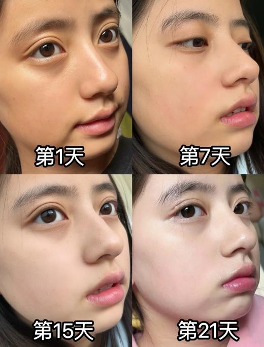 【4.12王炸割肉价】日本朝日制药美白颗粒美白饮30袋*1盒/3盒（效期至25.7月底） 商品图5