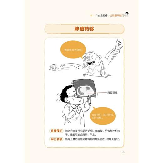 漫画肺癌 吴凤英 杜贺 从肺癌的基础知识病因病理分期诊断方法检查方法靶向治疗免疫治疗等临床试验等多个角度多个层面来阐述肺癌 商品图4