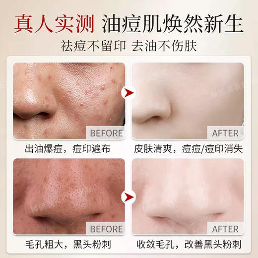 倾颜硫磺控油净颜洗面奶深层清洁面乳收缩毛孔黑头男女士 商品图6