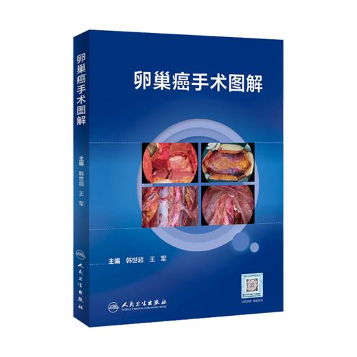 全2册 卵巢癌手术图解 + 宫颈癌手术难点与技巧图解（第2版）卵巢癌诊治指南黏液性瘤子宫内膜样瘤临床手术步骤视频腹腔镜  商品图2