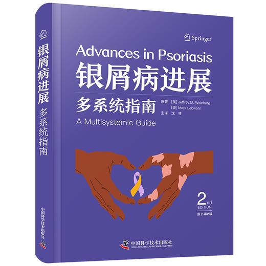 银屑病进展：多系统指南（原书第2版） 商品图1