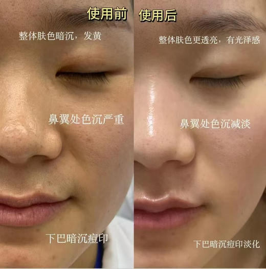 格丽缇素颜亮肤（美白）面膜 商品图8