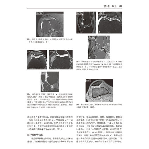 骨骼肌肉系统MRI结构化评估 如何实用地填写报告 袁慧书 程晓光 主译 肌肉骨骼系统-核磁共振成像 影像学 北京大学医学出版社 商品图4