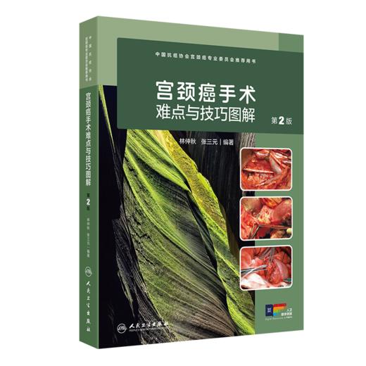 全2册 卵巢癌手术图解 + 宫颈癌手术难点与技巧图解（第2版）卵巢癌诊治指南黏液性瘤子宫内膜样瘤临床手术步骤视频腹腔镜  商品图3
