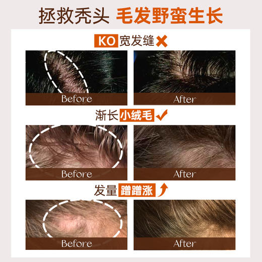 【4周生发固发】西班牙Nuggela&Sule 头发再生安瓶生发液40毫升 商品图2