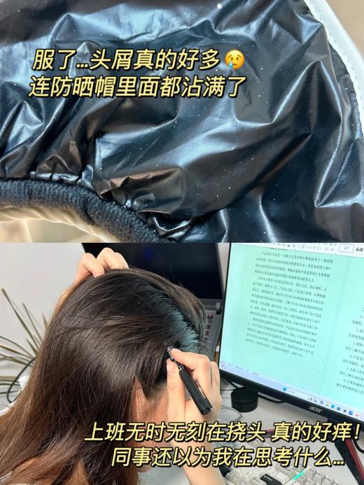 专业头屑吸尘器韩水仙头屑宁头皮素 商品图14