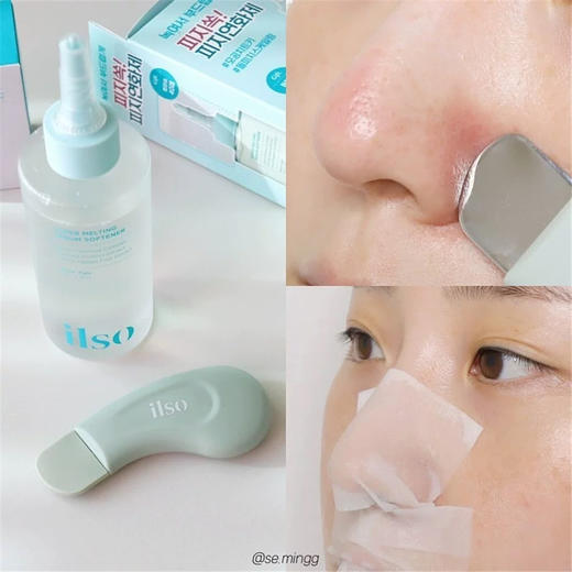 赠品翻倍升级！超好用！去黑头太绝了！ilso导出液黑头水150ml 商品图3