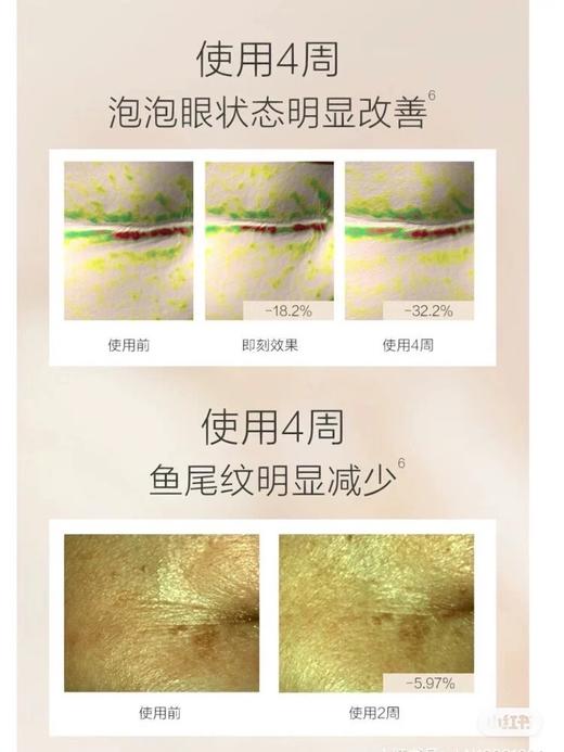 Z然堂抄底2盒20对黑晶亮彩封神的淡纹眼膜 商品图12