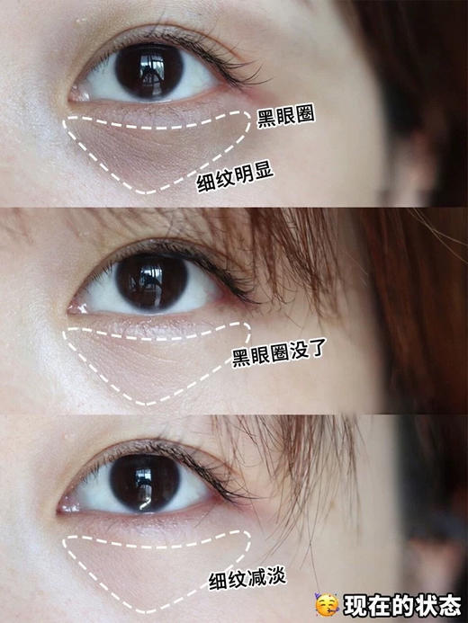 Z然堂抄底2盒20对黑晶亮彩封神的淡纹眼膜 商品图9