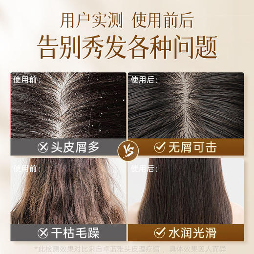 【去屑止痒】生姜去屑经典款洗发水400ml/800ml 温和舒缓头皮（3号/3A） 商品图4