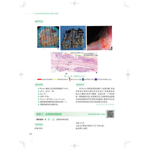 消化道早期肿瘤内镜诊治思路与策略 秀出镜彩 LCI/BLI菁英病例大赛获奖病例精析 张澍田 主编 9787547870389上海科学技术出版社 商品图4