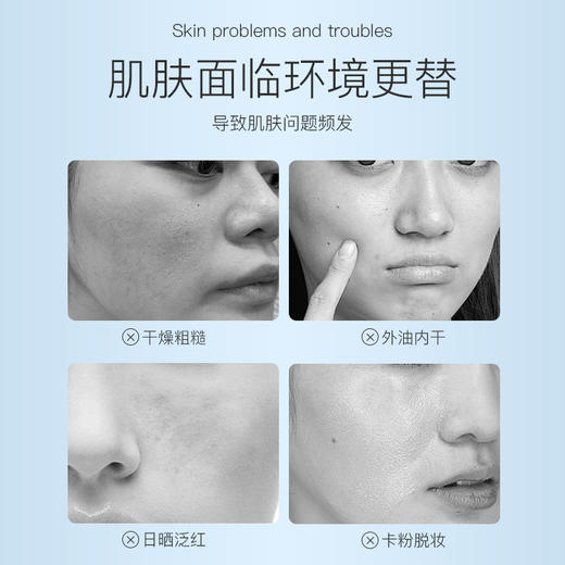 【超模君严选 下单即赠湿敷棉】夏季补水神器    Anfany 舒缓平衡喷雾  100ml/支 商品图1