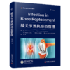 膝关节置换感染管理 膝关节置换感染相关管理策略 膝关节置换术后感染的治疗和预防 商品缩略图0