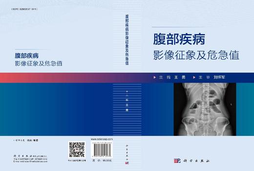 腹部疾病影像征象及危急值 商品图3