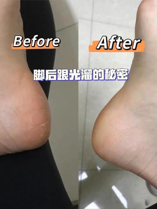 【英国XIPULANG西普朗磨脚器】好用不痛!磨一磨死皮老茧说拜拜!后脚跟嫩回“婴儿足"纯欲天花板 只需要一杯奶茶钱，体验10秒快速除茧磨皮 商品图2