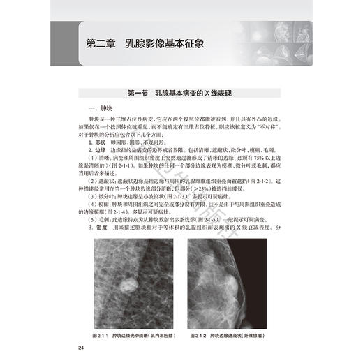 乳腺疾病影像征象分析思路 丁莹莹编 本书是以乳腺常见影像征象为出发点 深入探讨同影异病的征象在临床实践中的诊断及鉴别诊断等 商品图4