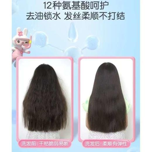 英氏儿童洗发水男童女童专用护发素3-15岁男女童氨基酸去屑洗发水 商品图4